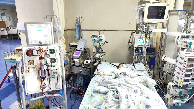 PICU里，上了ECMO+CRRT 的小依依。浙大兒院供圖
